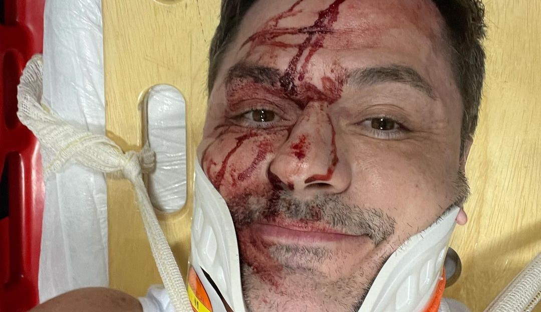 Danilo Faro, irmão de Rodrigo Faro sofre grave acidente de carro em São Paulo