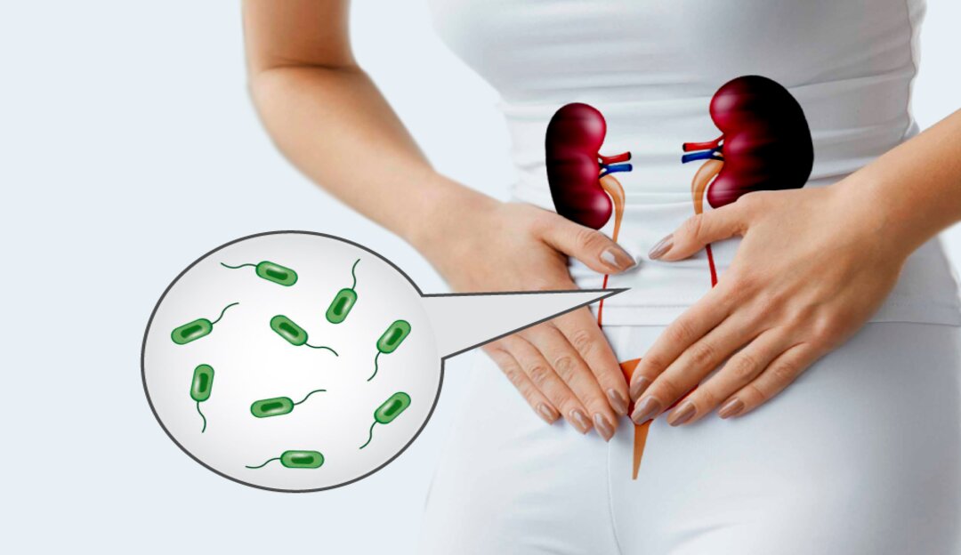 Entenda como o clima pode afetar o sistema urinário