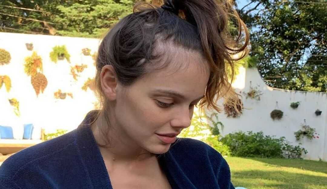 Laura Neiva sobre epilepsia: “Sempre foi um tabu”