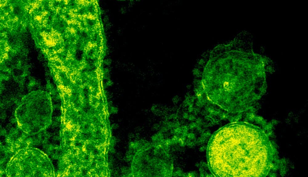 Estudo revela que  Ômicron tem 40% menos chance de hospitalização