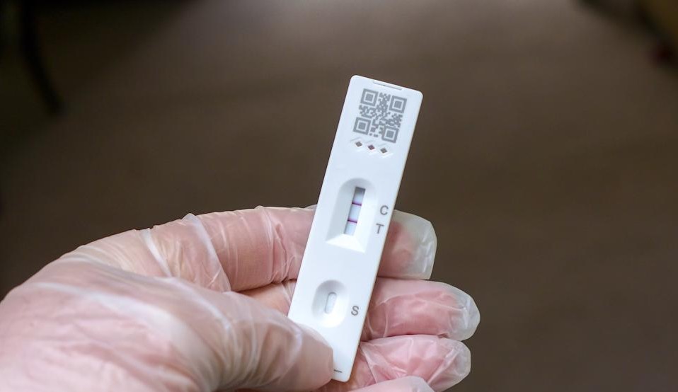 Brasil bate a marca de ter dois recordes consecutivos de testes diários em farmácias