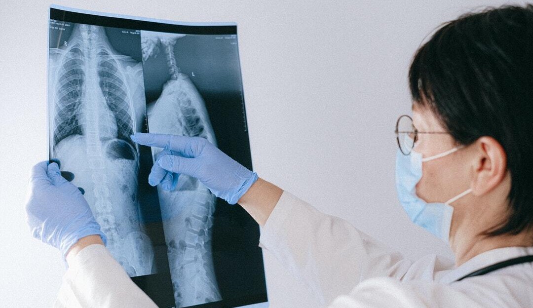 Fundação Oswald Cruz aponta forte crescimento de casos de SRAG