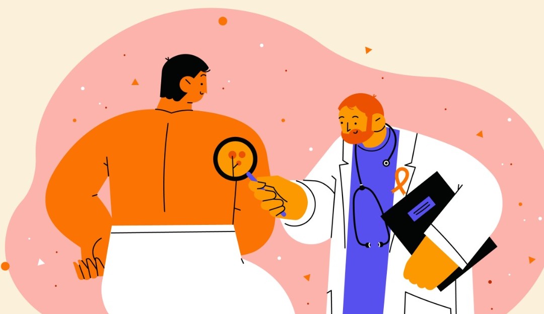Indícios de câncer de pele e como o prevenir