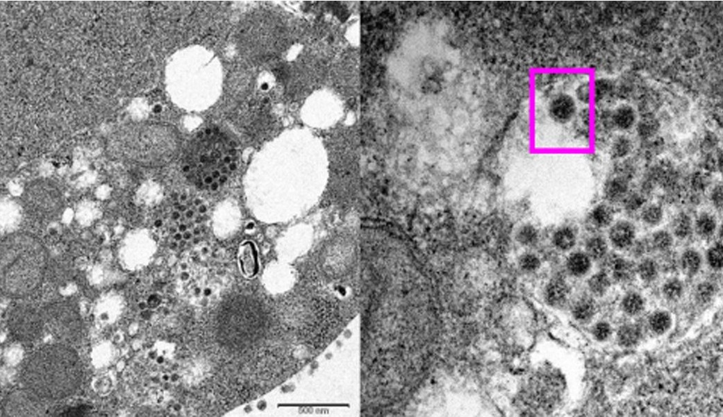 Subvariante da ômicron BA.2 é um terço mais contagiosa do que ‘original’
