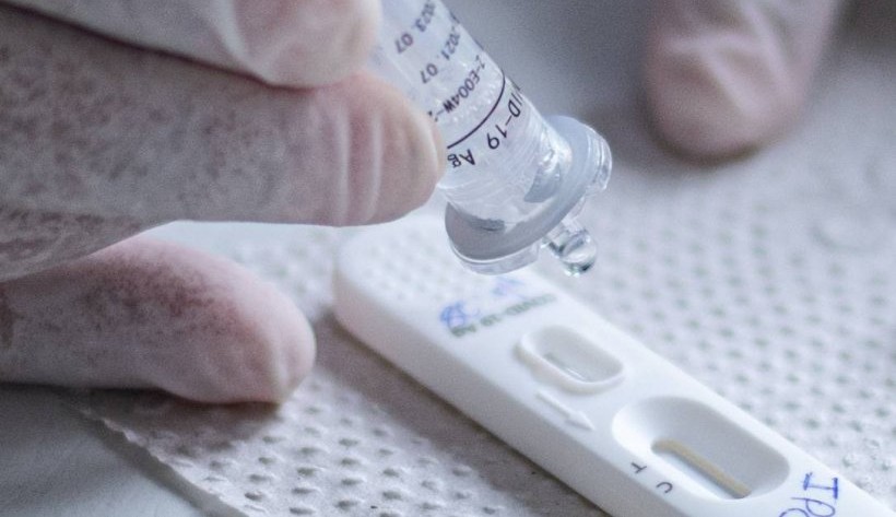 Covid-19: Quando fazer o teste para sair do isolamento?