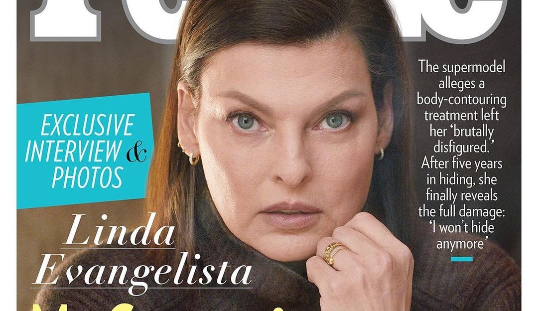 CoolSculpting: Procedimento que deformou o corpo de Linda Evangelista