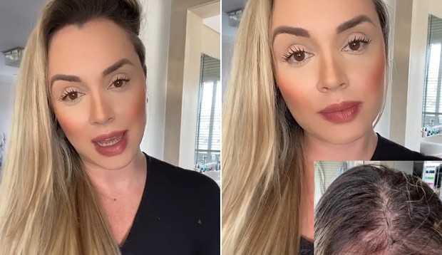 Saiba os motivos da queda de cabelo na pandemia e como solucionar