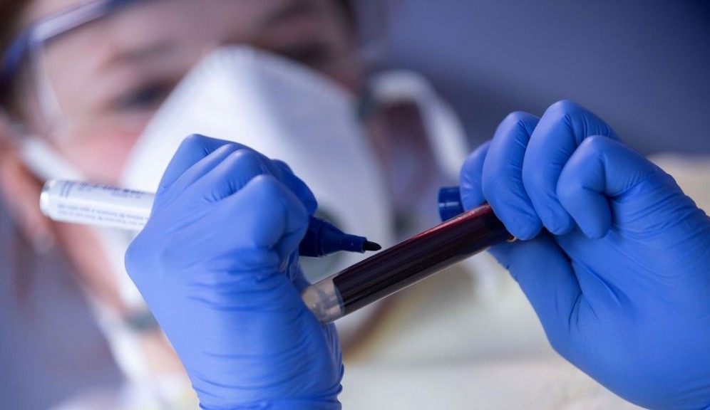 Conselho de Ética Médica aprova novo protocolo de tratamento contra LLA