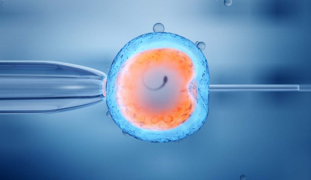 Entenda o que é a fertilização in vitro