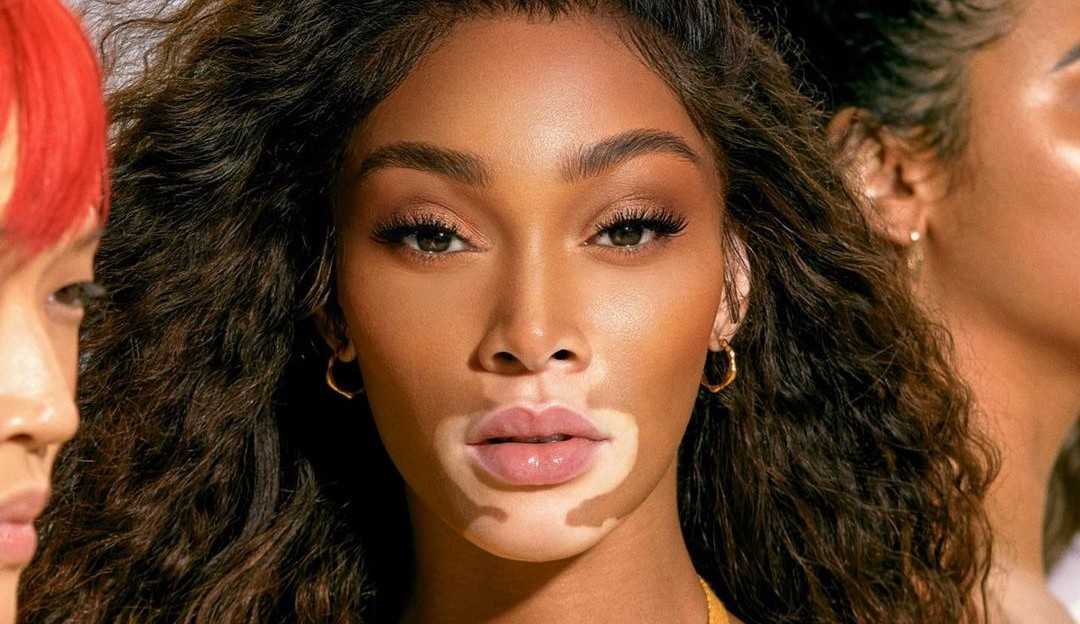 Winnie Harlow lança marca de beleza com foco em proteção solar