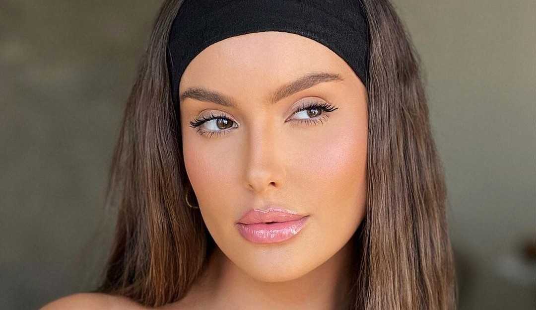 Thais Braz mostra cicatriz após cirurgia para reduzir testa