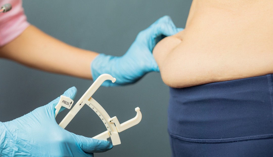 OMS se preocupa com o aumento nas taxas de sobrepeso e obesidade