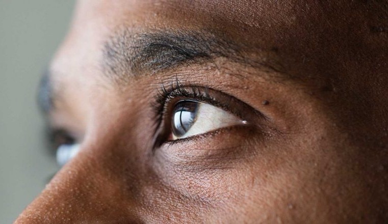 Nistagmo: conheça a condição que afeta membro do Black Eyed Peas