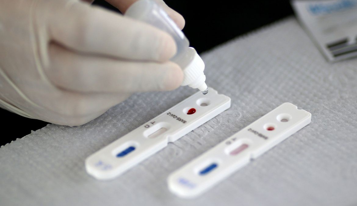 Passa de 20% a taxa de resultados positivos para Covid-19 no Rio de Janeiro