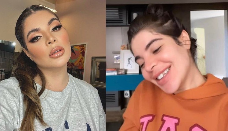 Gkay mostra sorriso “banguela” após danificar lentes dentárias