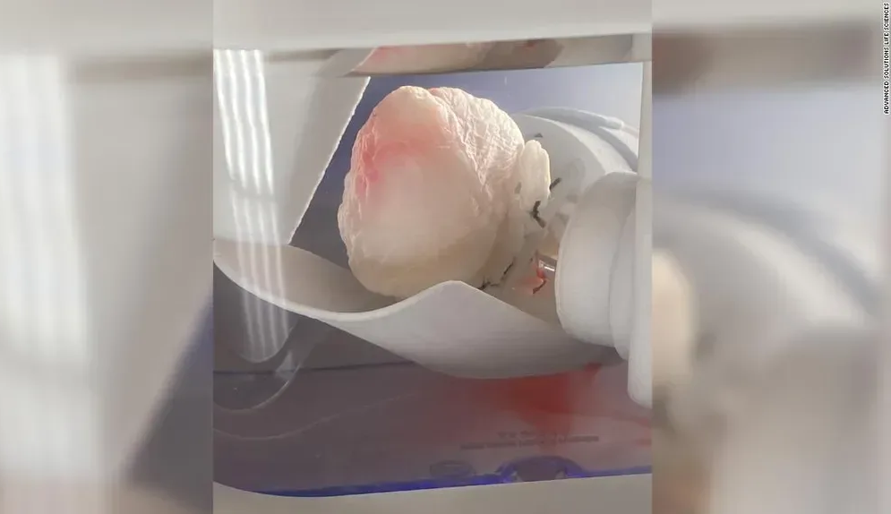 Coração de porco com células-tronco humanas: Corações híbridos que prometem ajudar em transplantes