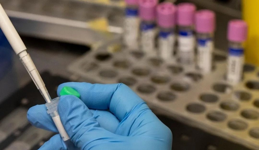 Brasil registra terceiro caso da varíola dos macacos