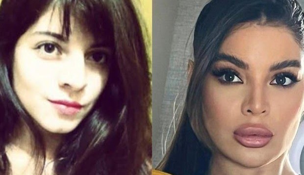 Gkay recebe críticas sobre sua aparência após procedimentos estéticos