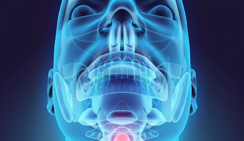 Câncer de cabeça e pescoço: conheça causas, sintomas e maneiras de reduzir os riscos da doença