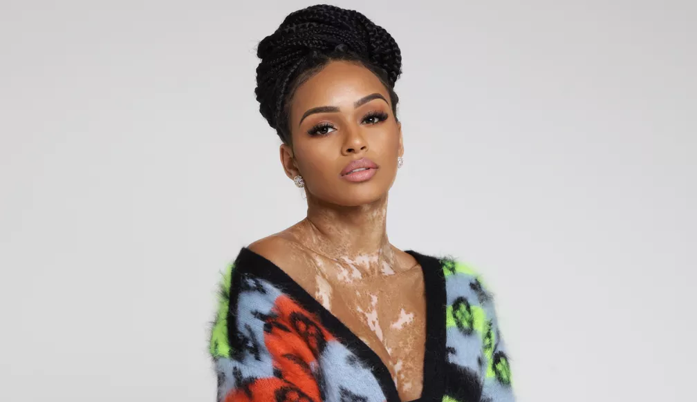 Natália Deodato expõe agência que gerenciava suas redes: “Sempre fui muito prejudicada”