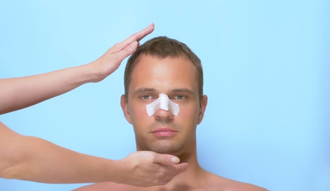 Veja os riscos de fazer rinoplastia caseira