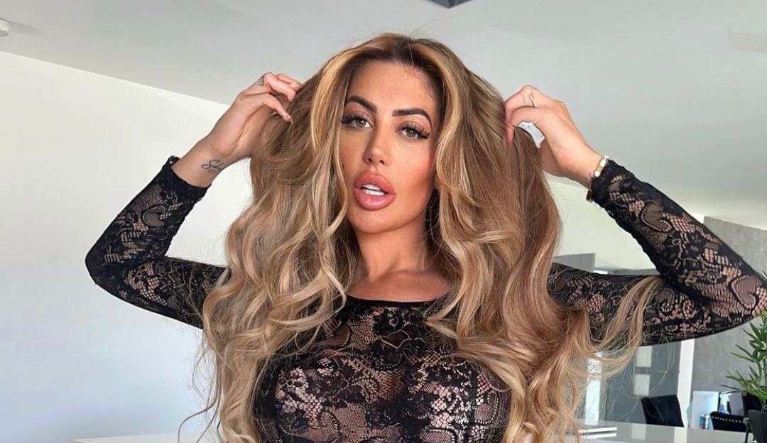 Estrela de reality internacional tem problemas com cirurgia plástica e fica com cicatriz no rosto