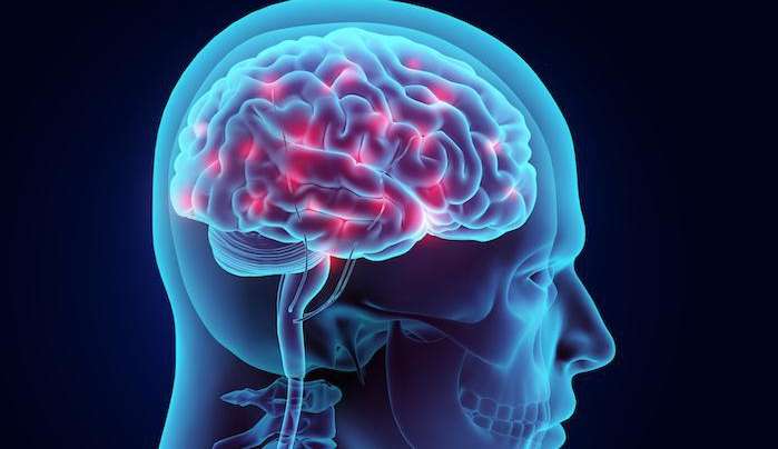 Acidente vascular cerebral: entenda como o AVC atinge mais gravemente as mulheres que os homens