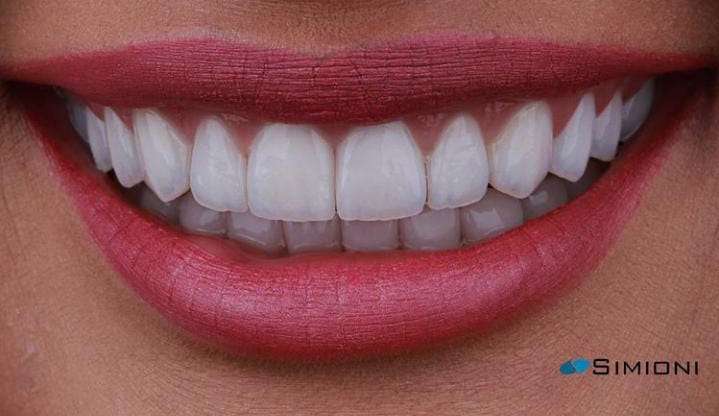 Lentes de contato: tudo o que você precisa saber sobre o procedimento que é febre entre os famosos