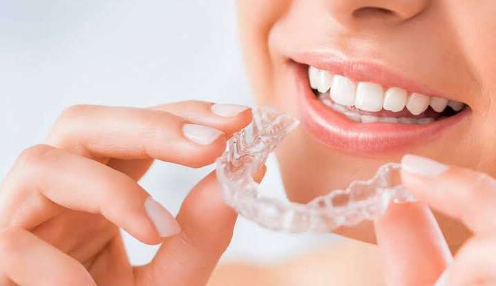 Invisalign: conheça procedimento que substitui aparelhos ortodônticos