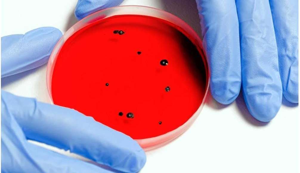 Rio Grande Do Sul confirma 150 casos de varíola dos macacos