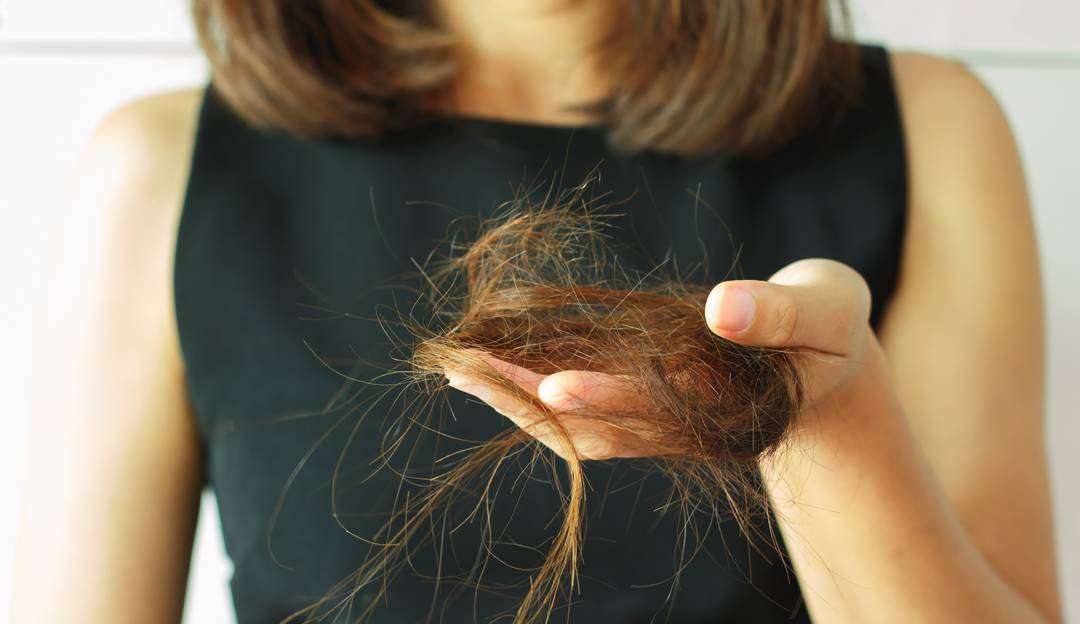 Minoxidil: saiba mais e decida se é aliado ou vilão da queda capilar