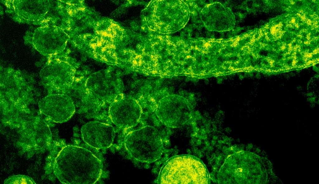 Cientistas: bactéria que causa IST pode se tornar superresistente