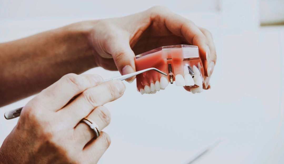 Evite dentaduras: use a Prótese Protocolo! Conheça as vantagens desse procedimento