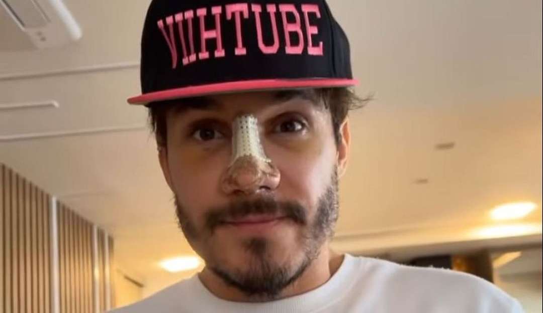 Ex-BBB Eliezer retira os curativos e pontos da rinoplastia