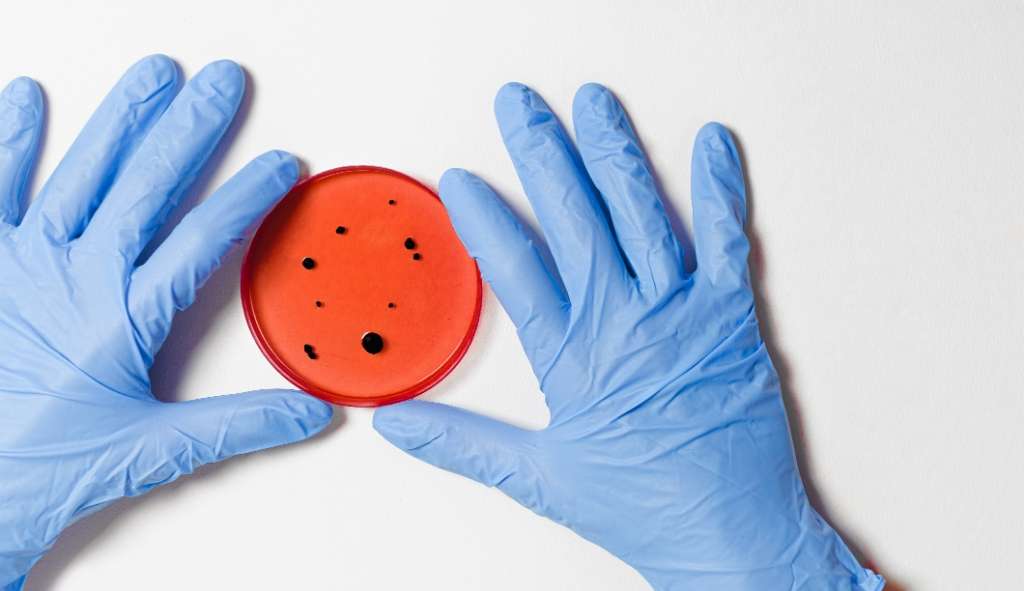 Minas Gerais tem segundo óbito por varíola de macacos