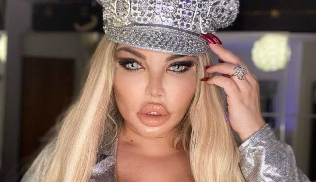 Jessica Alves conta como se sente um mês após cirurgia de mudança de sexo