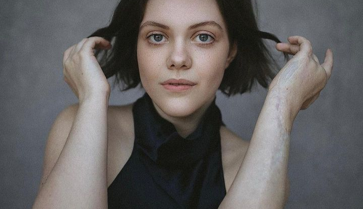 Atriz de ‘As Crônicas de Nárnia’ enfrenta infecção ‘carnívora’ mortal