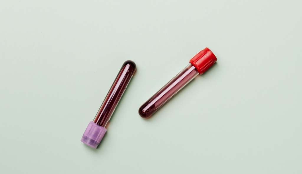 Cientistas fazem 1ª transfusão de sangue criado em laboratório