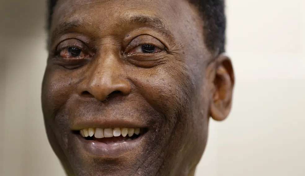 Estrutura montada em estádio preocupa fãs de Pelé