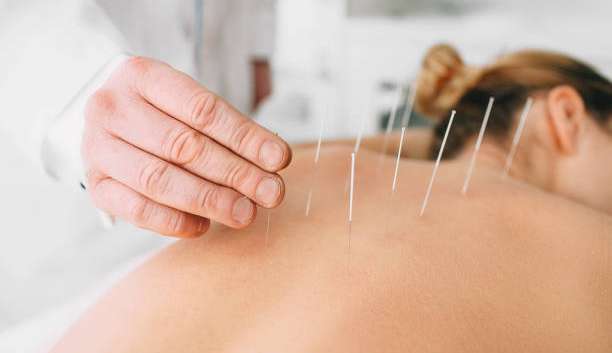 Como a acupuntura pode ajudar a lidar com a ansiedade?