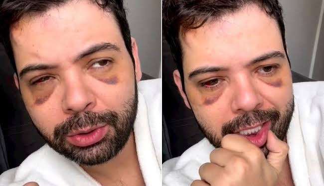 O humorista Gustavo Mendes se explica e admite que não houve “assalto”