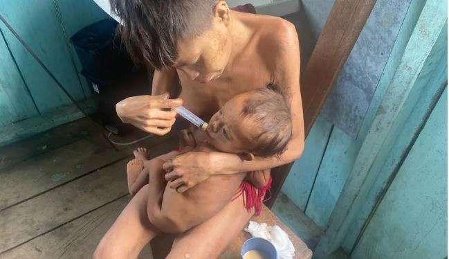 Ministério da Saúde entra com ação para avaliar saúde dos indígenas Yanomami