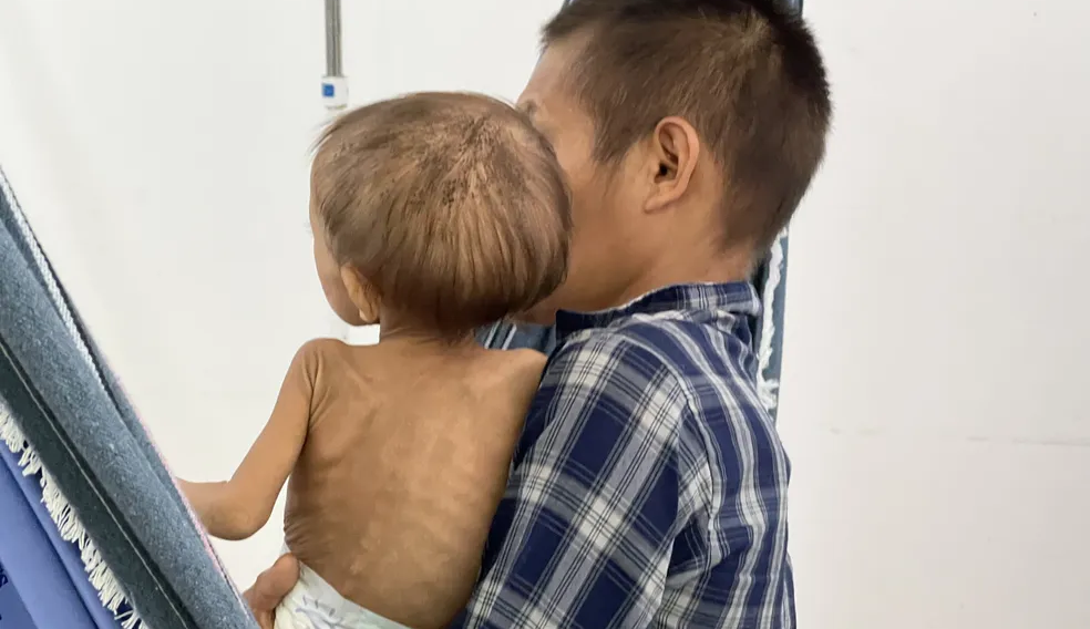 Crianças Yanomami recebem tratamento em hospital de Boa Vista