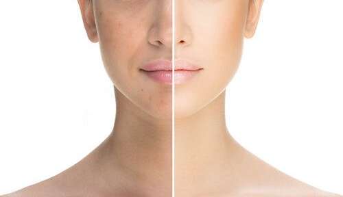 Dicas para prolongar os efeitos dos procedimentos estéticos