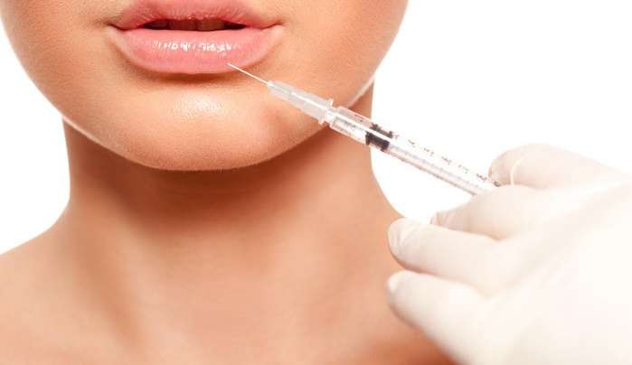 O que você precisa saber sobre preenchimento labial e outras alternativas estéticas