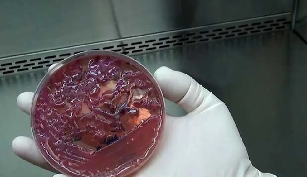 Entenda por que a superbactéria “KPC” pode ser mortal