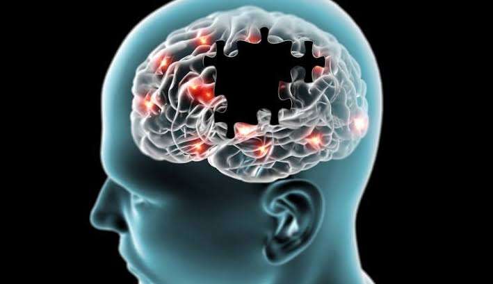 Farmacêuticas preparam exames de sangue para diagnosticar Alzheimer