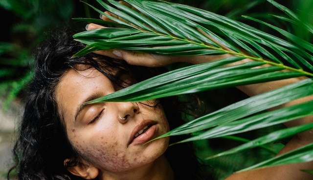 Por onde começar para entender e tratar pele com acne