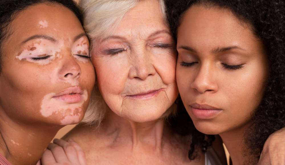 Skin positivity: liberdade para gostar da própria pele e da pele de outros