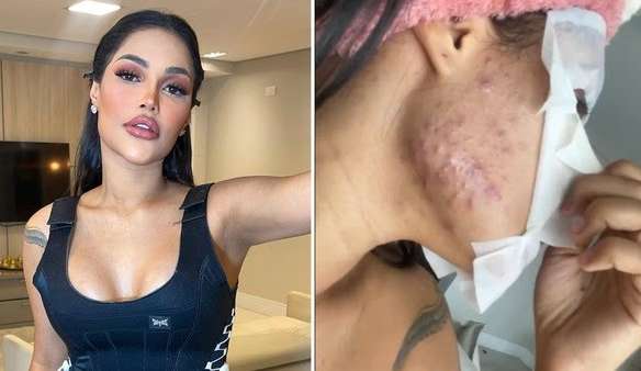 Flay fala do chip da beleza e diz: “Ganhei 10 quilos”